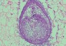 Revolucija u stomatologiji: Zubi iz laboratorija postaju stvarnost